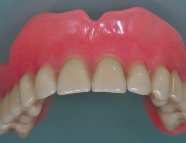 Totalna zobna proteza